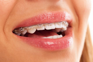 Dr. P. Barnard, Orthodontics available at Perfect Smile Dental, Stewart, FL Dentist